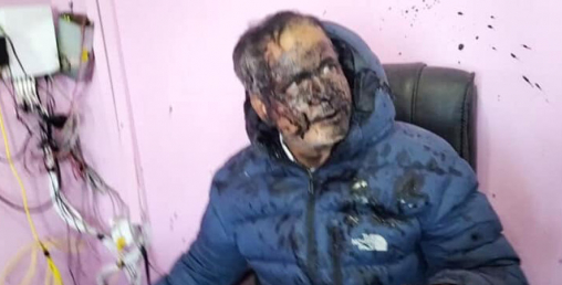 यातायात कार्यालयका प्रमुख बाबुरामलाई कालो मोसो दलियो