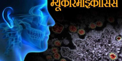 कोरोना जितेका पनि ब्ल्याक फङ्गसले छोडेन, मृत्युदर ५० प्रतिशत भन्दा धेरै