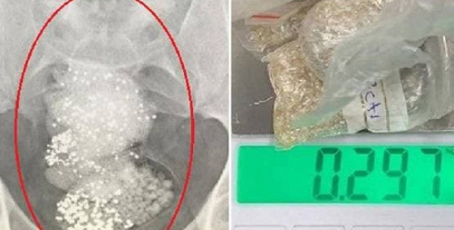 पेटभीत्र ६४ लाखको हीरा, विमानस्थलमा खुल्यो यस्तो राज