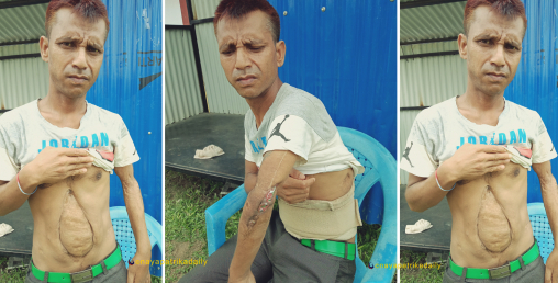 मेयरलाई ३० लाख क्षतिपूर्ति, उही घटनाका घाइतेले उपचार खर्च पनि पाएनन्
