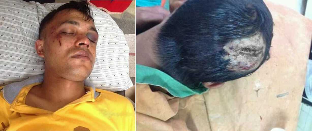 दशैँमा घर गएका प्रहरी जवान कुटपिट गरी झाडीमा फाल्ने ६ जना पक्राउ