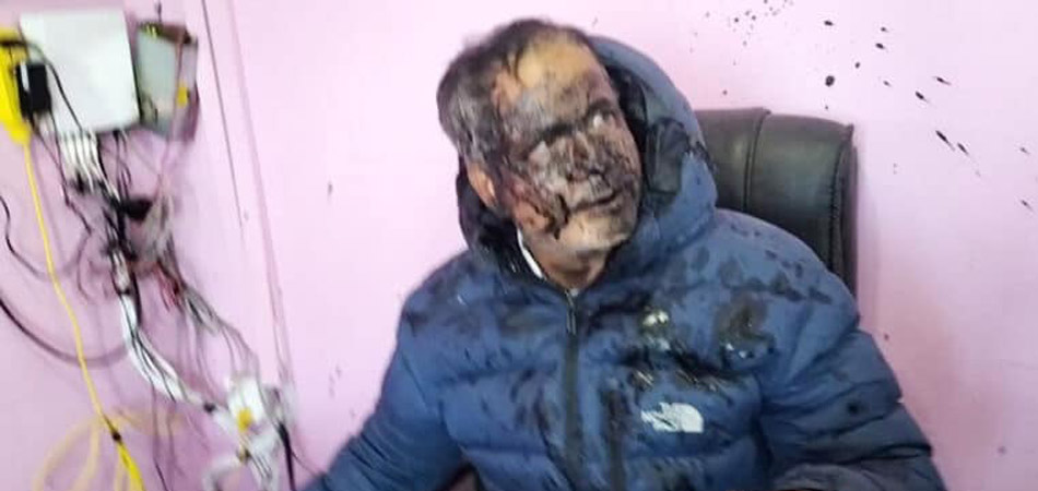 यातायात कार्यालयका प्रमुख बाबुरामलाई कालो मोसो दलियो