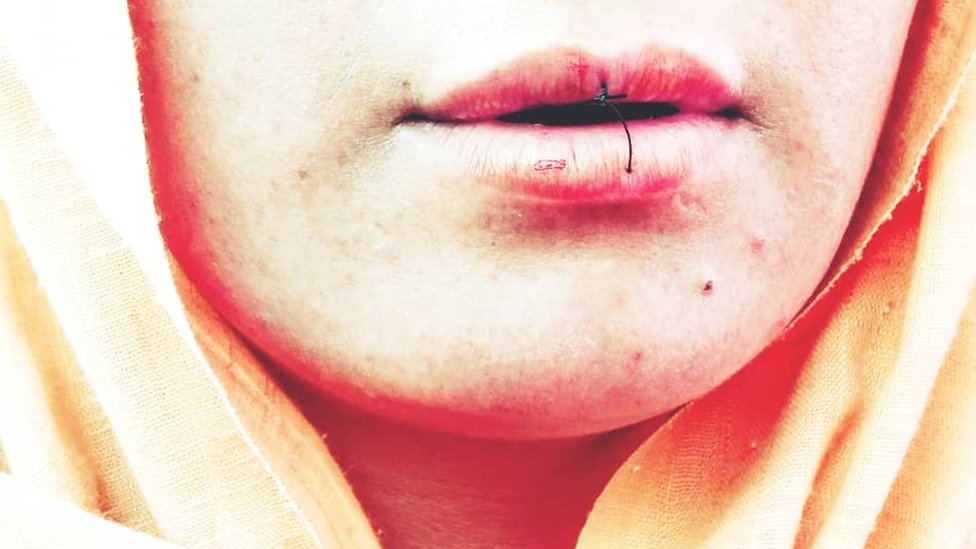 यि महिलाहरुले आफ्नै ओठ किन सिलाए ?