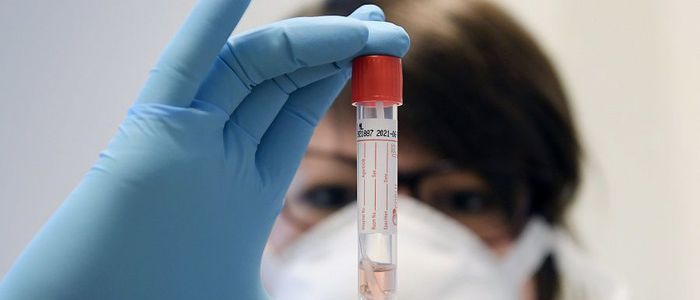 दुबइबाट फर्केका एकमा ‘एन्टीबडी पोजेटिभ’