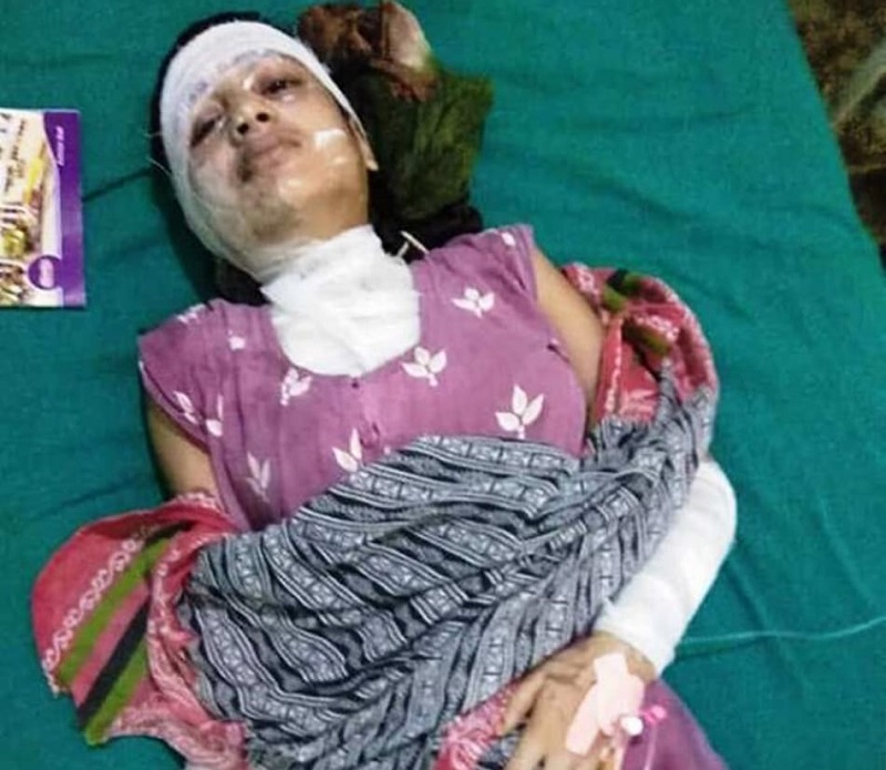 आफ्नै भन्नेले एसिड छ्यापे, किन हुन्छ योजनाबद्ध एसिड कान्ड ?
