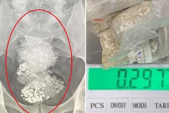 पेटभीत्र ६४ लाखको हीरा, विमानस्थलमा खुल्यो यस्तो राज