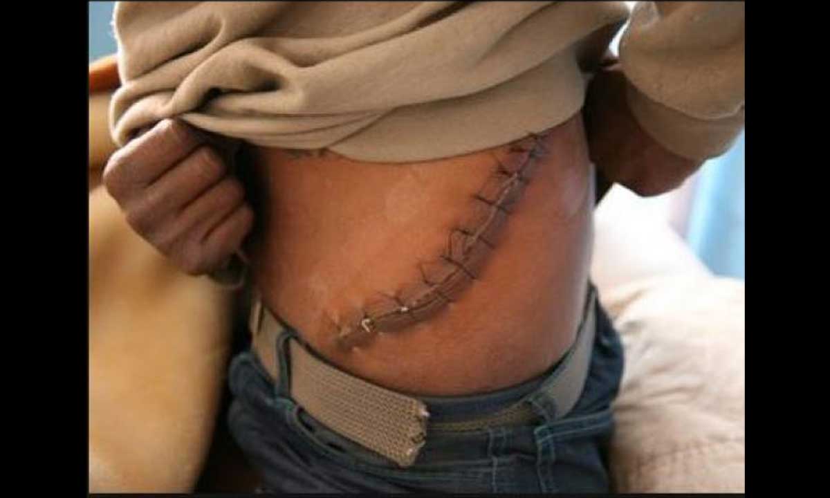 धन्न जोगियो मिर्गौला दिल्लीबाट पीडितको उद्धार