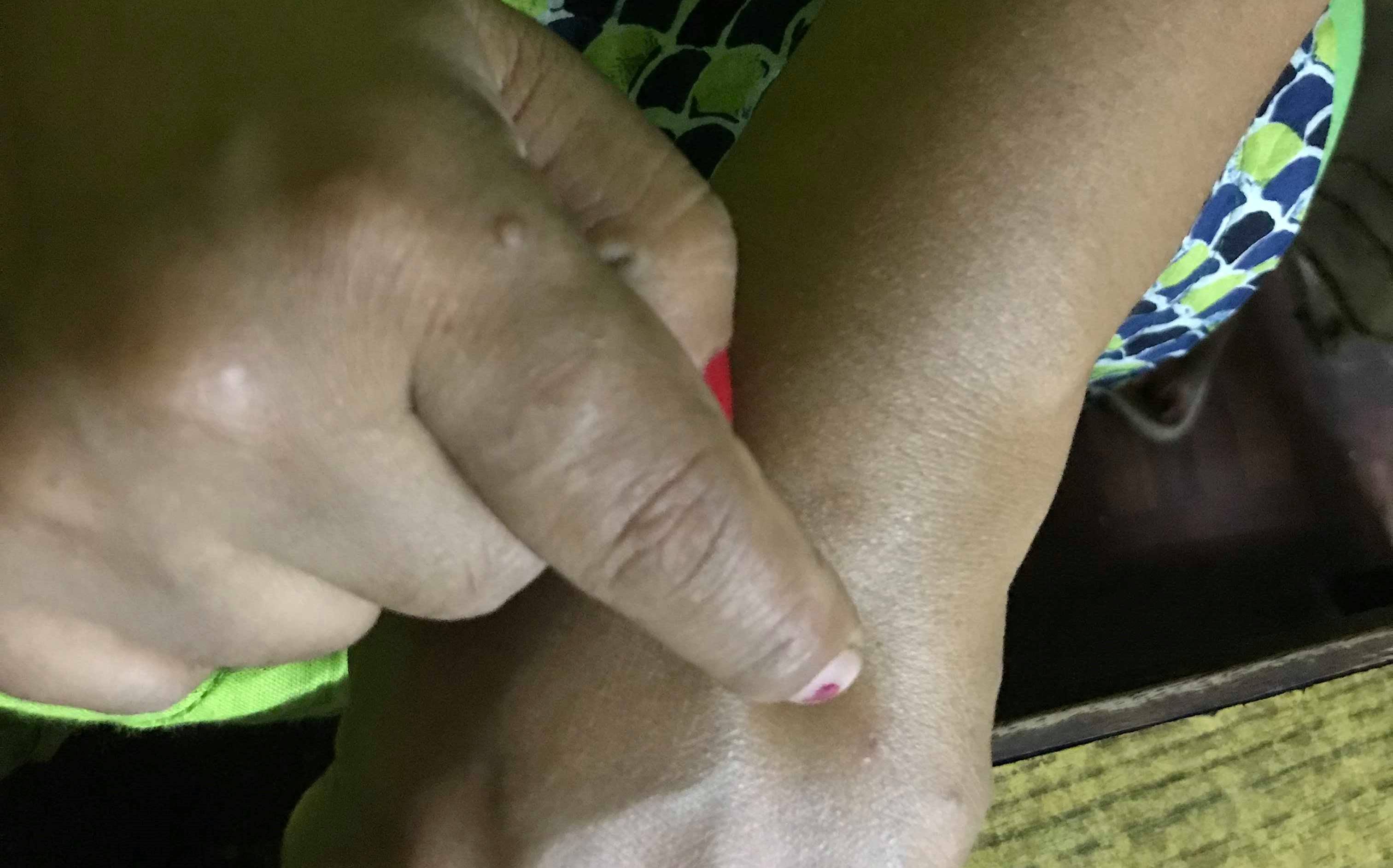बनेपामा पनि महिलामाथि युवतीले गरिन् सिरिन्ज प्रहार