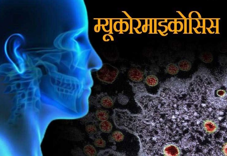 कोरोना जितेका पनि ब्ल्याक फङ्गसले छोडेन, मृत्युदर ५० प्रतिशत भन्दा धेरै