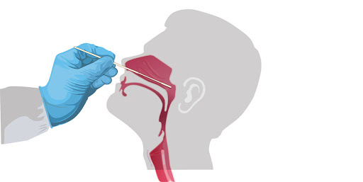 के स्वाब संकलन गर्दा मस्तिष्कमा क्षति पुग्छ ?